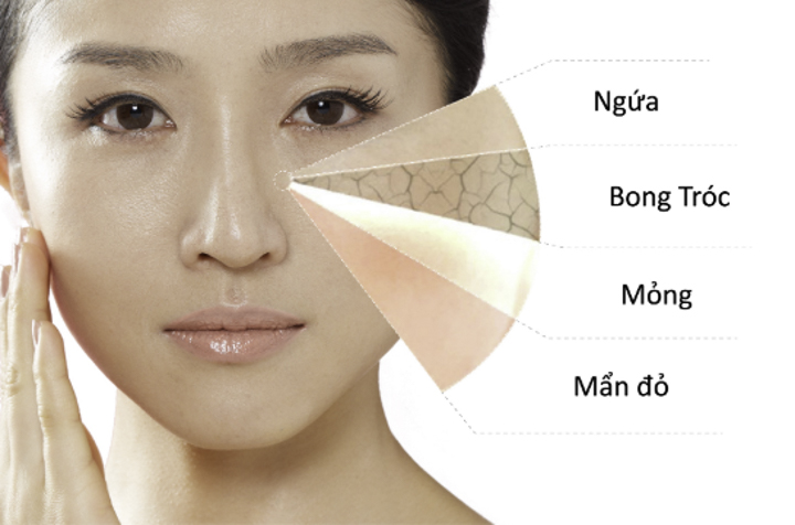 Những biểu hiện của làn da nhạy cảm